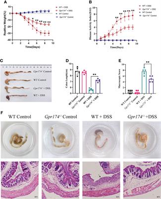 Gpr174 Knockout Alleviates DSS-Induced Colitis via Regulating the Immune Function of Dendritic Cells